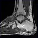 ANKLE JOINT